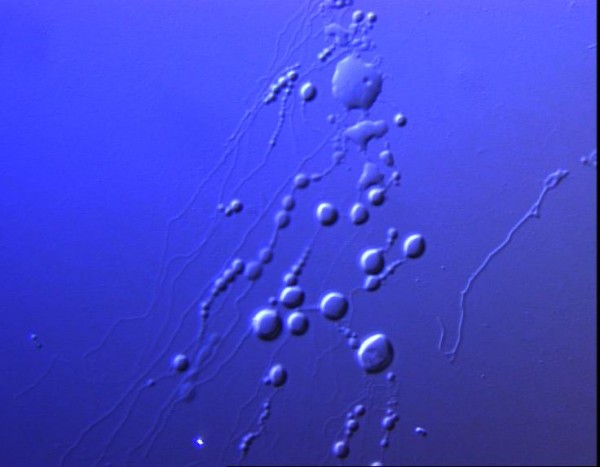 Nobel Prizes 2013: The shipping machinery of cells