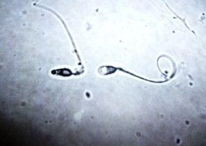 sperm