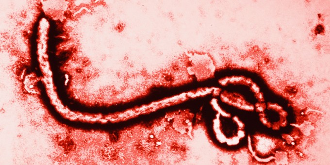 Ebola Virus at 108,000 Magnification. The Los Angeles bus passenger is not believed to have actually contained this virus within his person.