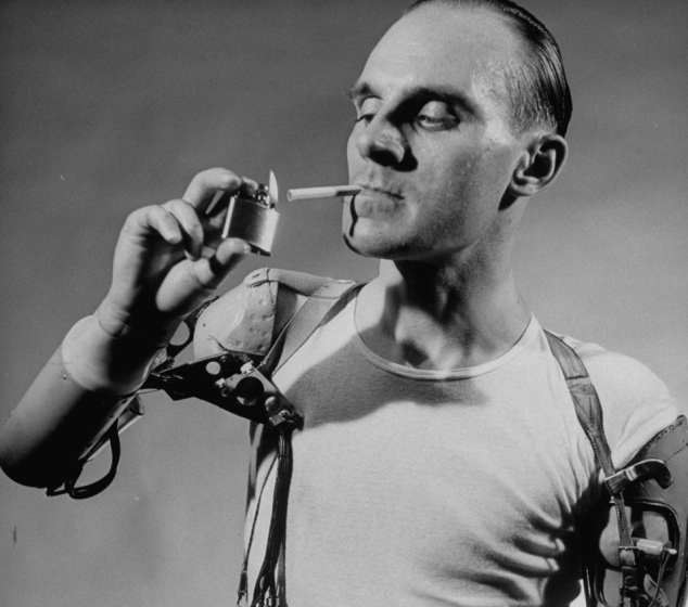 140912-artificial-limb-1950-cigarette