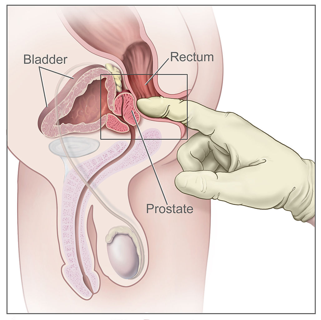 prostate