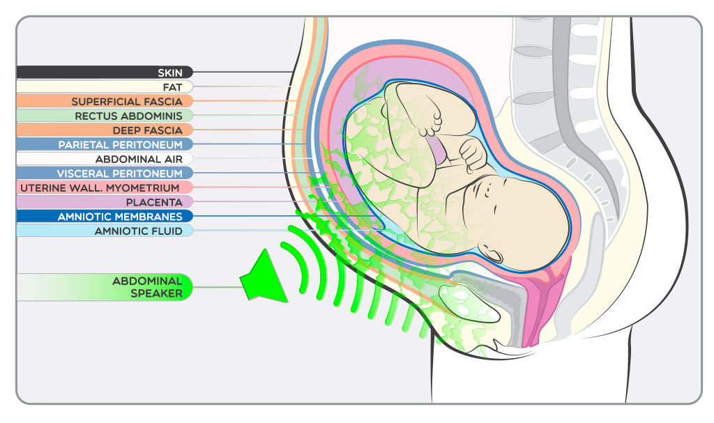 BabyPod-Altavoz-A-1_en