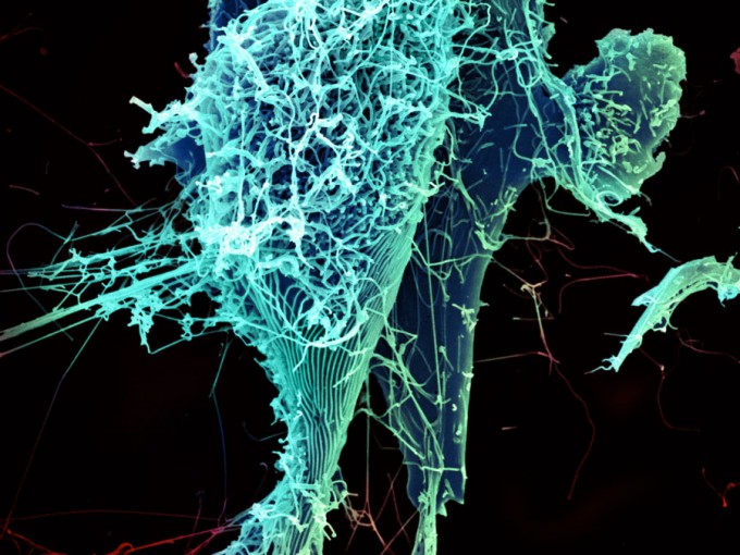 "String-like Ebola virus peeling off an infected cell." Heinz Feldmann, Peter Jahrling, Elizabeth Fischer and Anita Mora, National Institute of Allergy and Infectious Diseases, National Institutes of Health