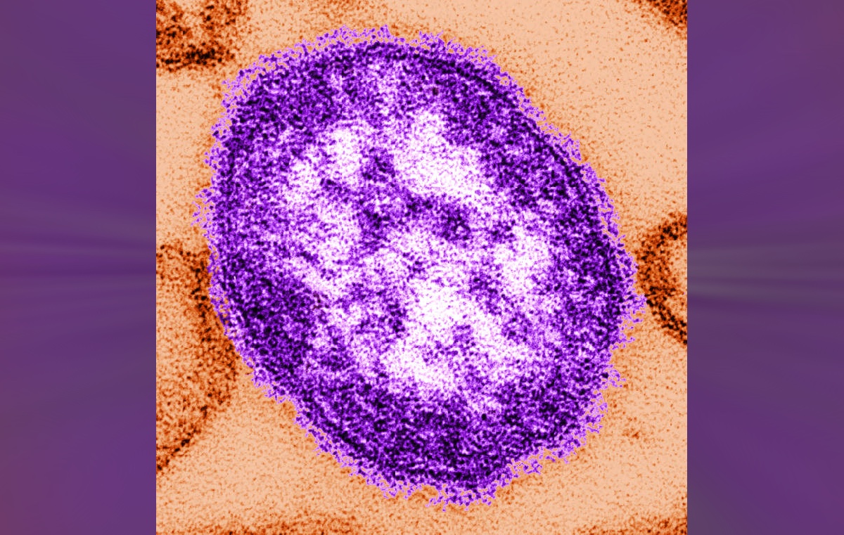 Measles virus. U.S. Centers for Disease Control.