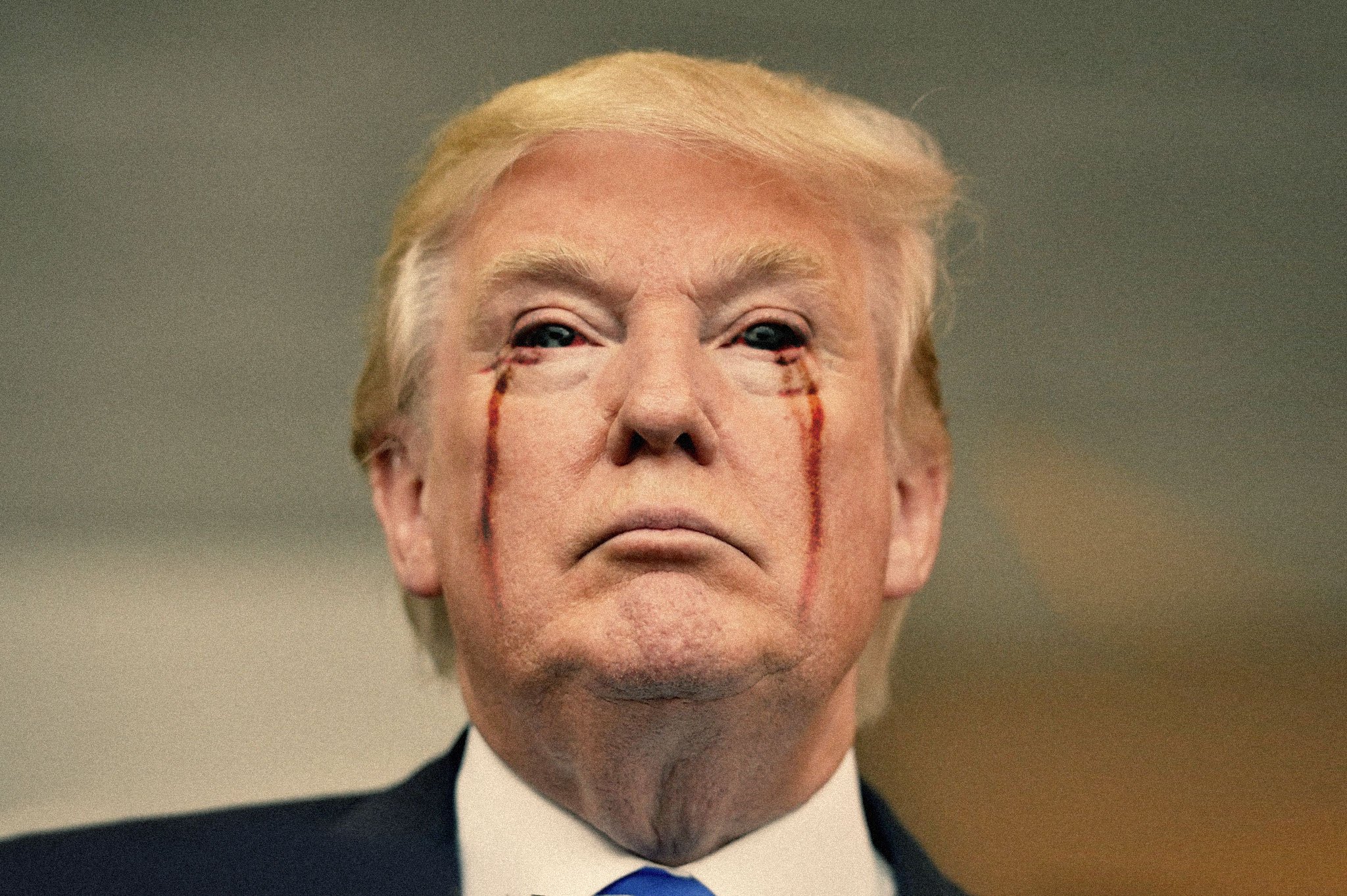 trump-his-eyes-bleeding